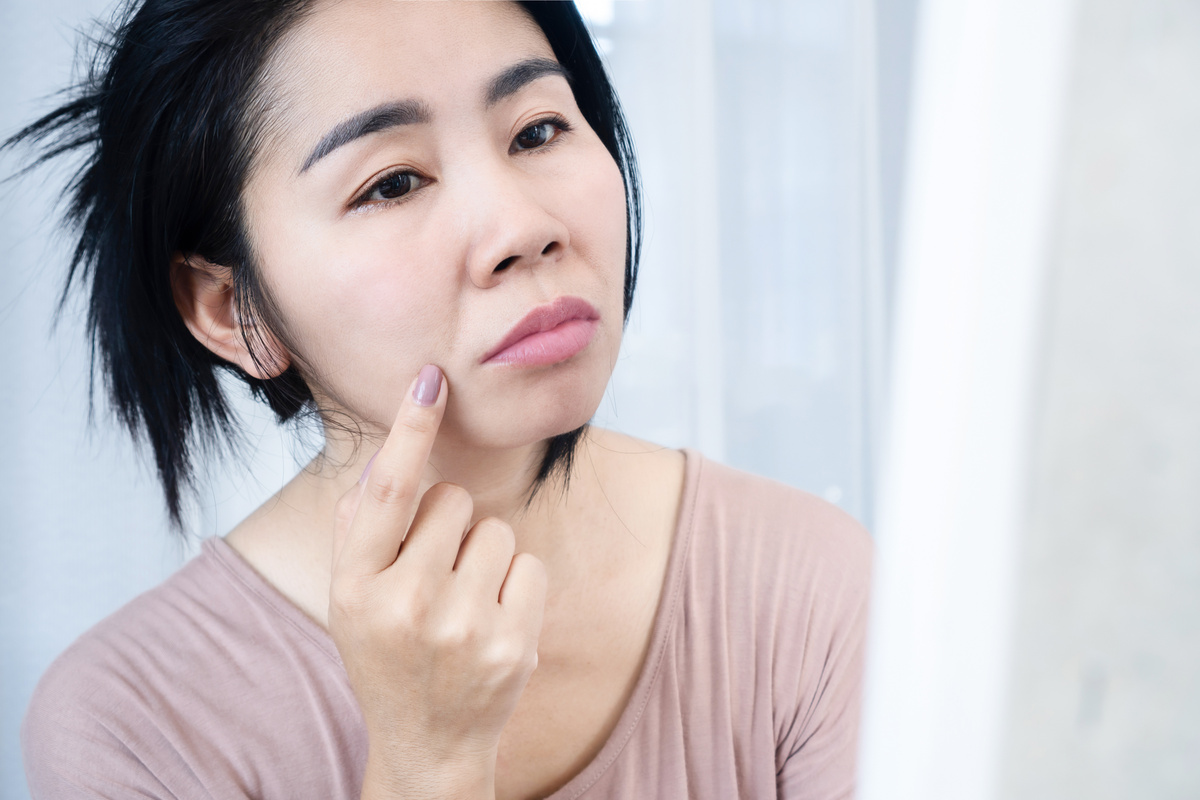 Asian woman worries face aging  with winkle, with winkle skin nasolabial fold, smile lines, or laugh lines